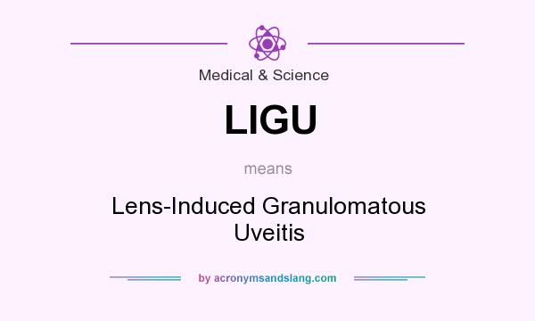 What does LIGU mean? It stands for Lens-Induced Granulomatous Uveitis