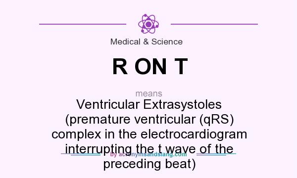 What does R ON T mean? It stands for Ventricular Extrasystoles (premature ventricular (qRS) complex in the electrocardiogram interrupting the t wave of the preceding beat)