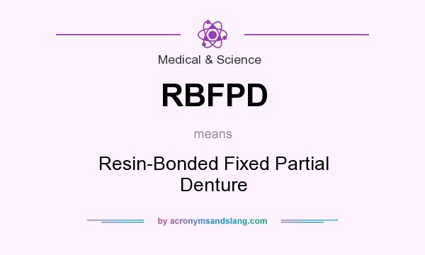 What does RBFPD mean? It stands for Resin-Bonded Fixed Partial Denture