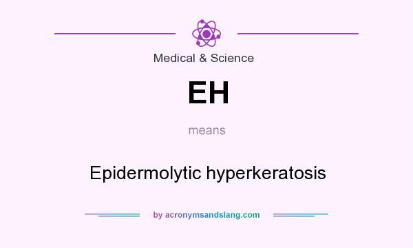What does EH mean? It stands for Epidermolytic hyperkeratosis