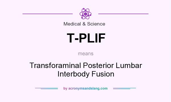 What does T-PLIF mean? It stands for Transforaminal Posterior Lumbar Interbody Fusion