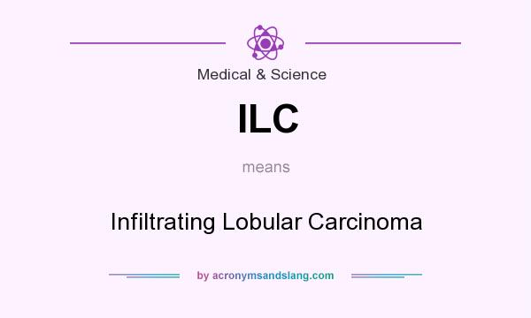 What does ILC mean? It stands for Infiltrating Lobular Carcinoma
